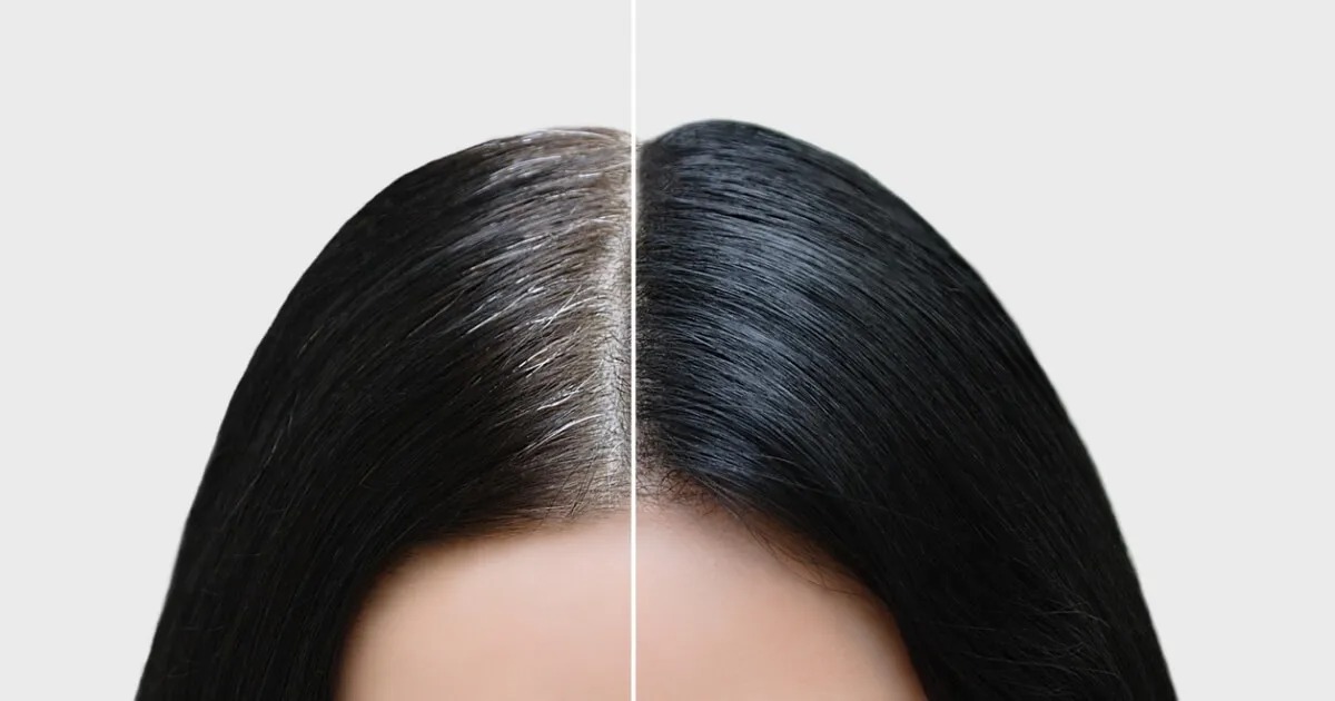 Beyaz Saç ve Kanser Arasındaki Gizemli Bağ Açığa Çıktı Beyaz Saç ve Kanser Arasındaki Gizemli Bağ Açığa Çıktı1